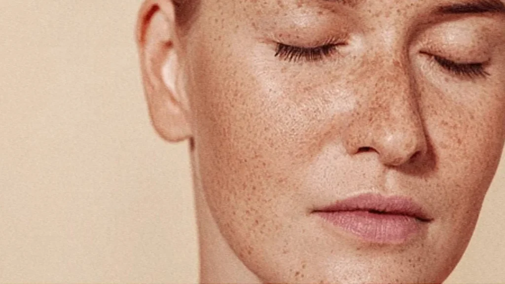 آیا ضدآفتاب لکههای صورت را از بین میبرد؟ بررسی علمی و راهکارهای مؤثر 1 Anti-Pigmentation-Sunscreen02