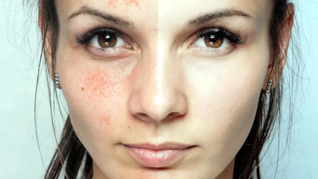 فواید شگفت انگیز آلوورا برای پوست + 5 روش استفاده از روش 1 amazing benefits of aloe vera for skin02